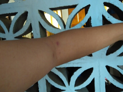 saya mencoba teknik pai da dan hasilnya begini. keringatan, panas.